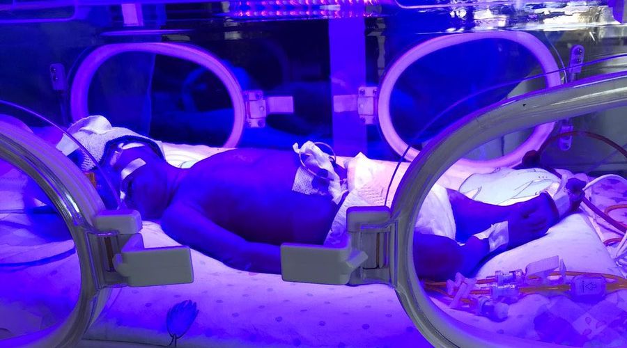 Kuvözden düşen bebeğe serebral palsi teşhisi konuldu, ailesi şikayetçi oldu Kuvözden düşen bebeğe serebral palsi teşhisi konuldu, ailesi şikayetçi oldu